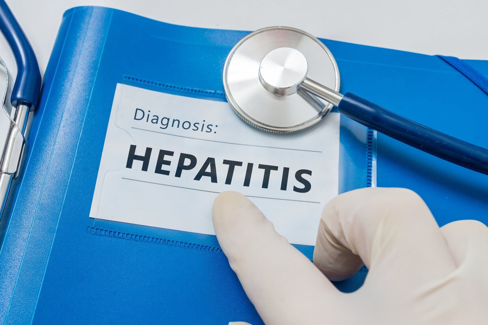 Hepatitis C: hogyan védjük a beteg máj egészségét?